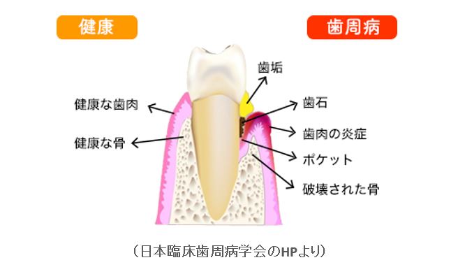 398-1_sishubyou3_Web